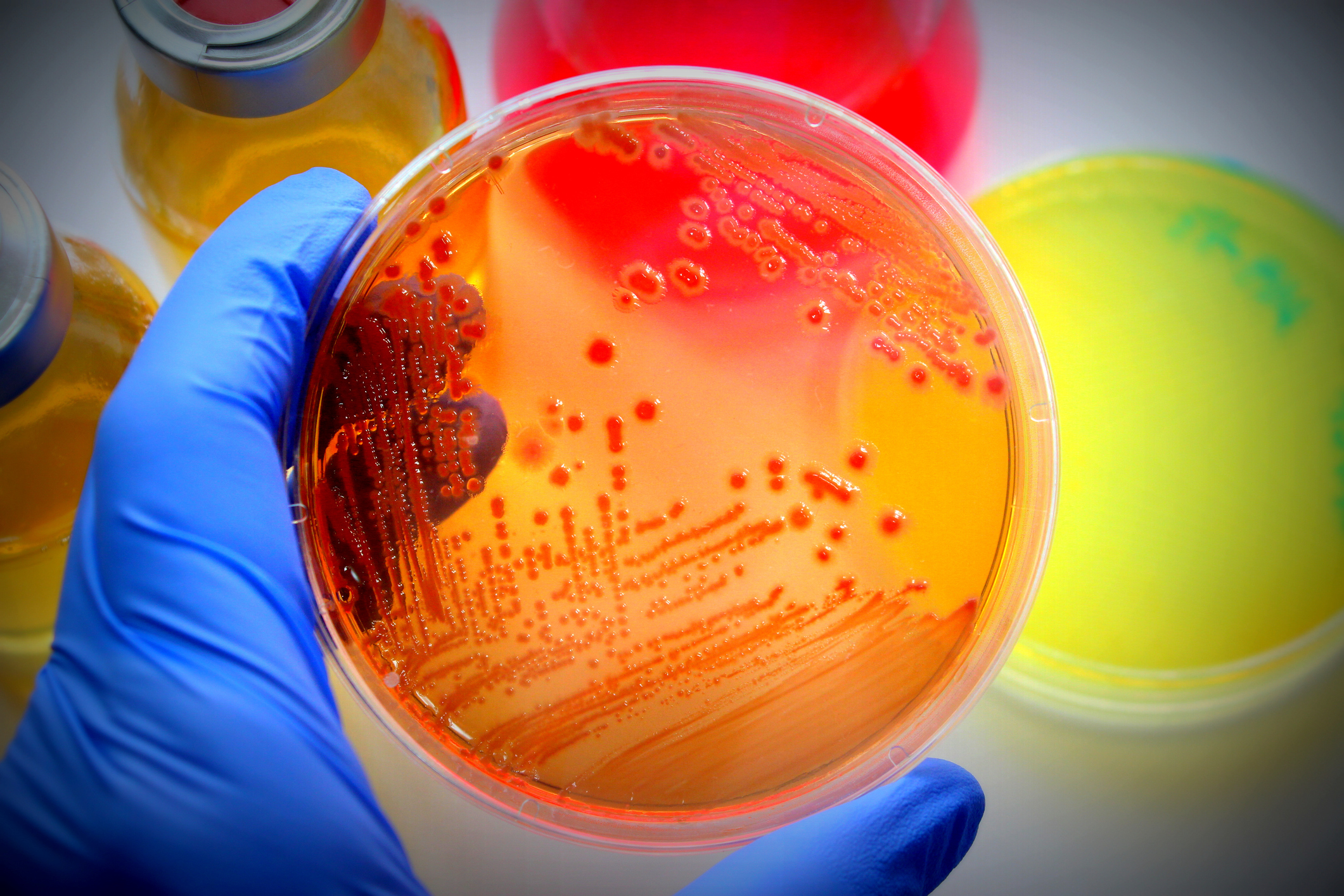 Petri dishes are shown in a microbiology lab